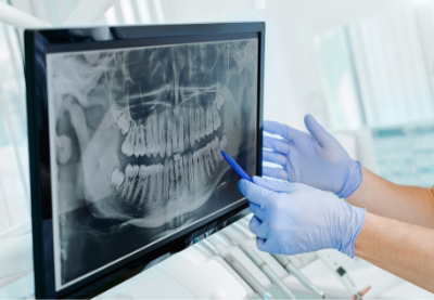 dental-assistant-looking-at-digital-xrays-on-a-computer-screen