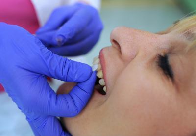 patient-being-fitted-for-veneers