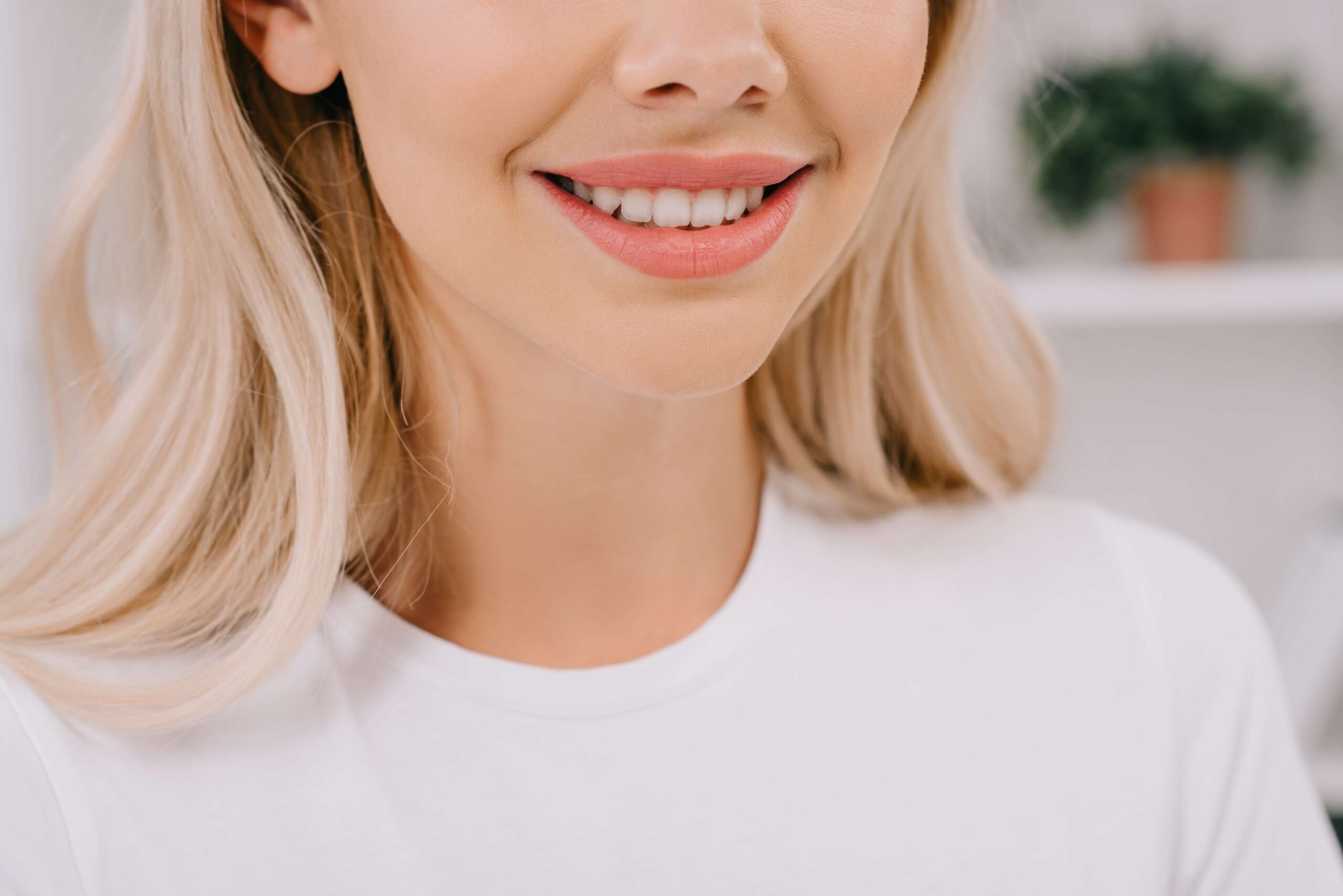 Featured image for “Can veneers Stonestown, CA Improve Chips, Stains, or Tooth Shape?”